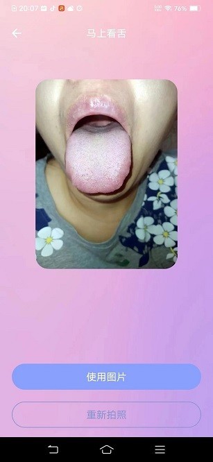 ai看舌1