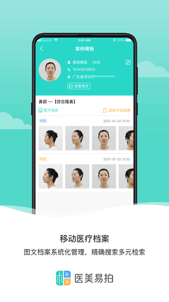 医美易拍软件截图1