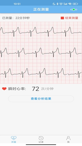 数维康心电图片2