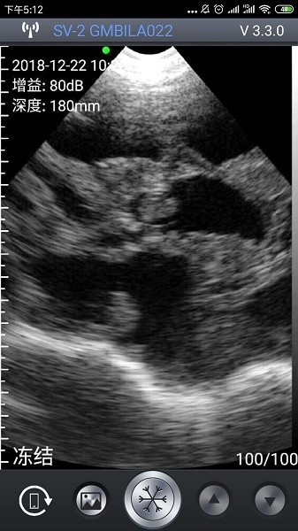 智能B超app1