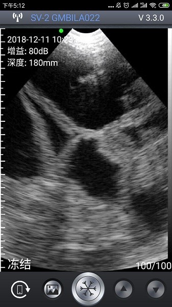智能B超app2