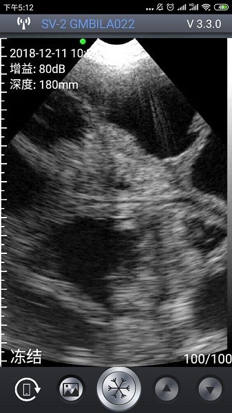 智能B超app3